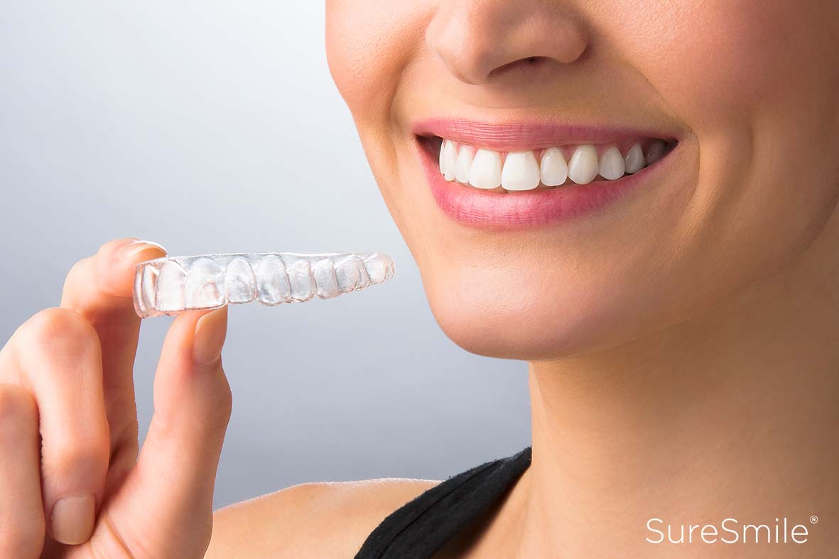 Orthodontie met SureSmile aligners in Hoofddorp