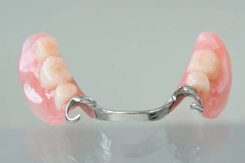 Frameprothese met dunne metalen basis en ankers